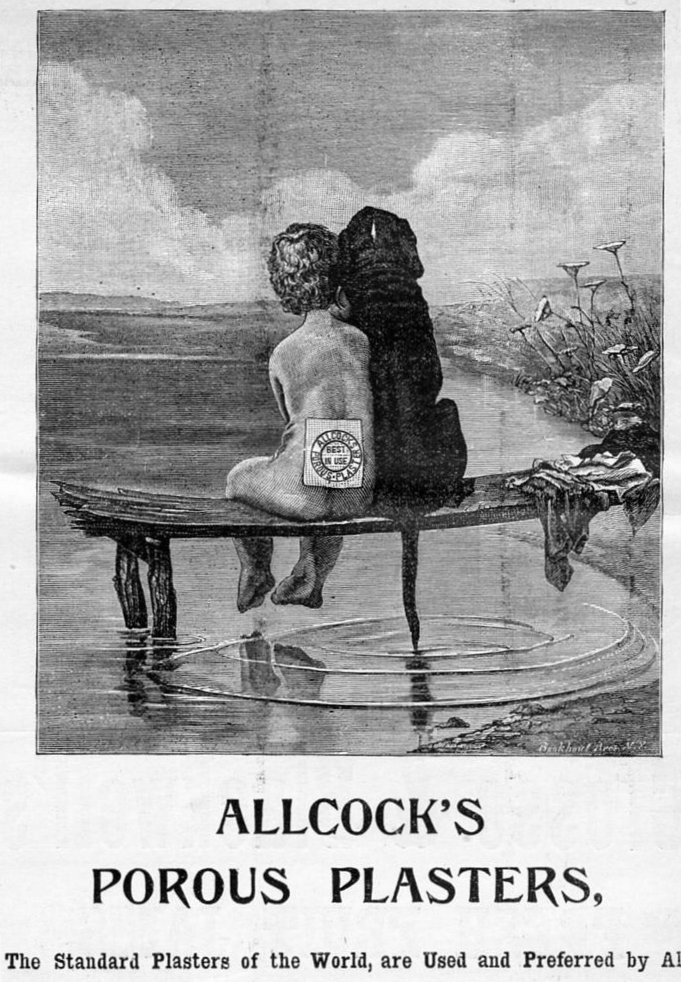 Allcock's Pflasters